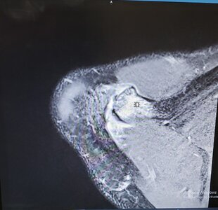 MRI.jpg