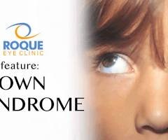 Brown Syndrome - Roque Eye Clinic