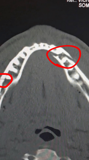 AA1SJlQG.png AA1SJlQG.png