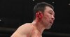 sakuraba-ear-injury.jpg