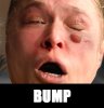 ronda bump.jpg