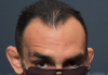 tony hairline.PNG