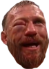 straight-cerrone-puffed-eye.png straight-cerrone-puffed-eye.png
