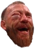 2cerrone-puffed-eye.png 2cerrone-puffed-eye.png