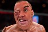 pet berry donald cerrone eye.jpg
